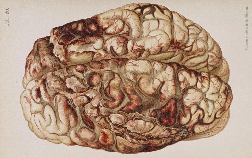 Trauma In Emmanuel Levinas’ Writing Body, Part 1 (Magdalena Sedmak)
